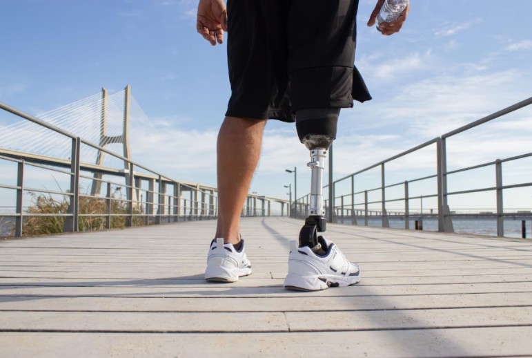 The Ultimate Guide to Outdoor Activities With a Prosthetic Leg